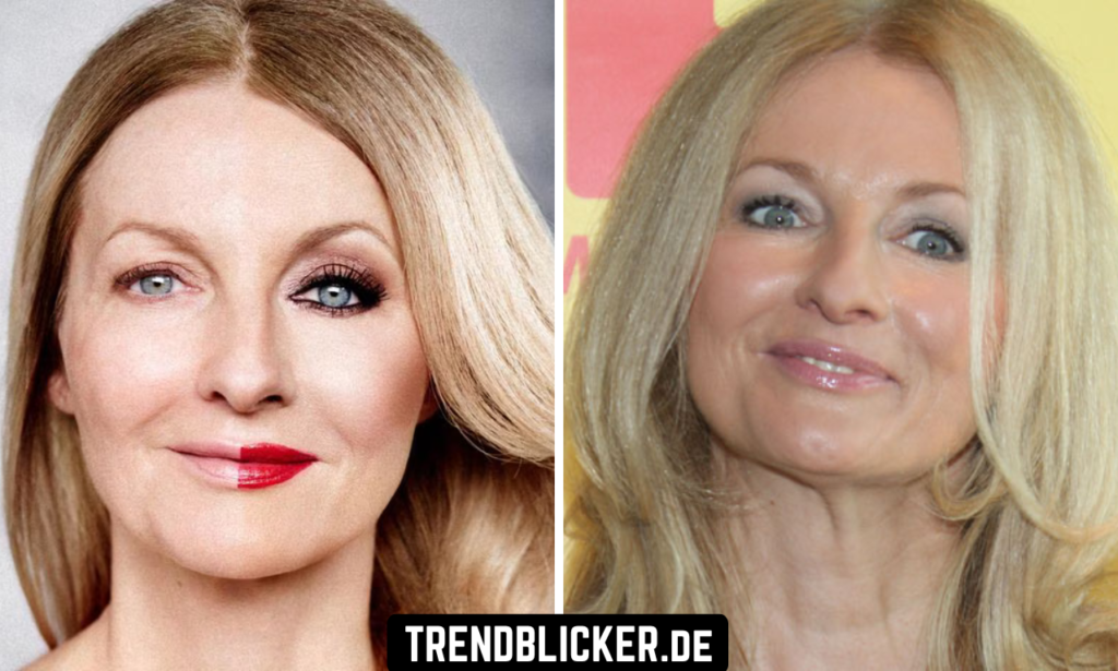 Frauke Ludowig Schlaganfall: Warum dieses Thema gerade alle beschäftigt