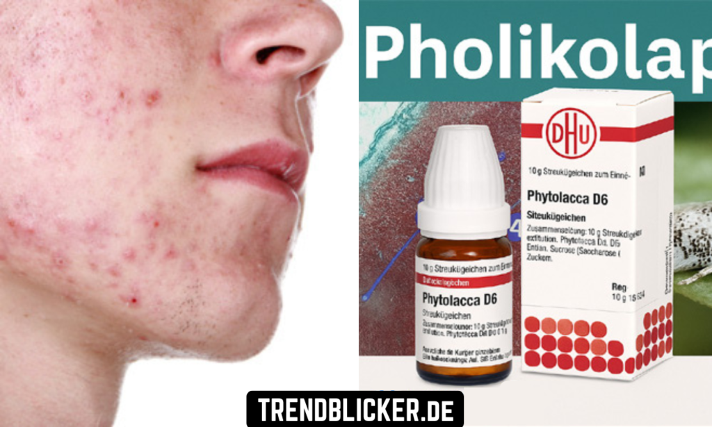 Pholikolaphilie verstehen: Definition, Ursachen und warum alle darüber sprechen